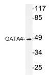 AP20302PU-N - GATA4