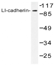 AP20476PU-N - Cadherin-17