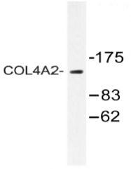 AP20477PU-N - Collagen type IV alpha 2 chain