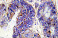 AP20477PU-N - Collagen type IV alpha 2 chain