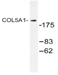 AP20478PU-N - Collagen type V