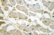 AP20478PU-N - Collagen type V