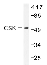 AP20298PU-N - CSK