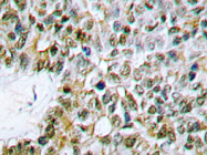 AP20294PU-N - Caspase-9