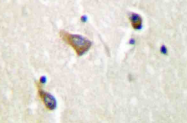 AP20482PU-N - Apolipoprotein J / Apo J