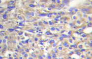 AP20487PU-N - Laminin beta-1 / LAMB1