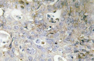 AP20488PU-N - Laminin gamma 1