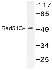 AP20492PU-N - RAD51C
