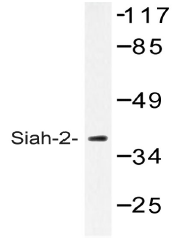 AP20493PU-N - SIAH2