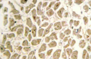 AP20493PU-N - SIAH2