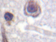 AP20293PU-N - CaSR