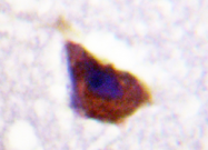 AP20290PU-N - Beta-2 adrenergic receptor