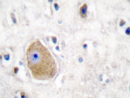 AP20285PU-N - HSD17B10 / ERAB