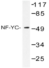 AP20495PU-N - NFYC