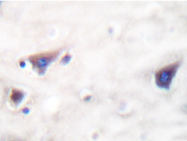 AP20280PU-N - Kinase suppressor of Ras 1