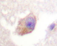 AP20275PU-N - Tryptophan 5-hydroxylase 1 (TPH1)