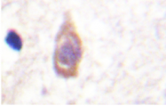 AP20273PU-N - TGFBR2