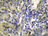 AP20272PU-N - Cystatin-A