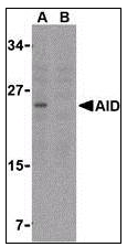 AP07447PU-N - AICDA / AID