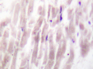 AP20265PU-N - Phospholipase D1 / PLD1