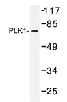 AP20264PU-N - PLK1