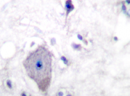 AP20262PU-N - CD140a / PDGFRA