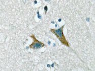 AP20257PU-N - DUSP1 / MKP1