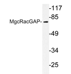 AP20256PU-N - RACGAP1