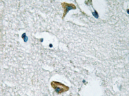 AP20252PU-N - Tyrosine-protein kinase JAK3