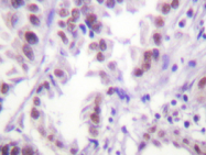 AP20241PU-N - Histone H3