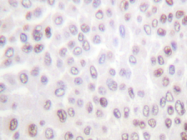 AP20239PU-N - Histone H2B