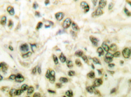 AP20235PU-N - HDAC3