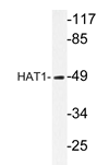 AP20234PU-N - HAT1