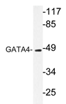 AP20231PU-N - GATA4