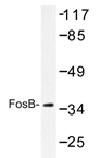 AP20229PU-N - FOSB