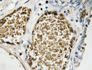 AP20229PU-N - FOSB