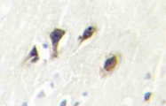 AP20387PU-N - MAPK8 / JNK1