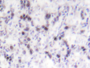 AP20216PU-N - CREB1