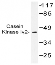 AP20394PU-N - CSNK1G2