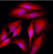 AM09381PU-N - Cytokeratin 18