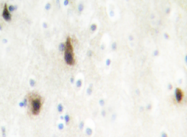 AP20432PU-N - Mevalonate kinase