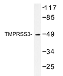 AP20427PU-N - TMPRSS3