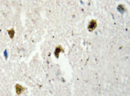 AP20424PU-N - hnRNP-H / HNRNPH1