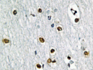 AP20422PU-N - GTF2A1 / TF2A1