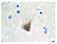 AP06282PU-N - PDGFB