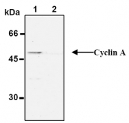 AM20282BT-N - Cyclin A2