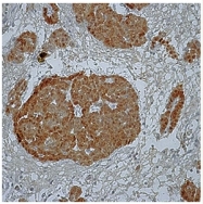 DRM010 - Calretinin