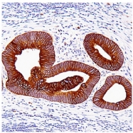 AM03166SU-N - Cytokeratin 20