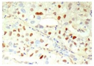 AM20285AF-N - Cyclin E1