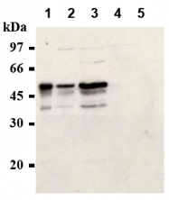 AM20285AF-N - Cyclin E1
